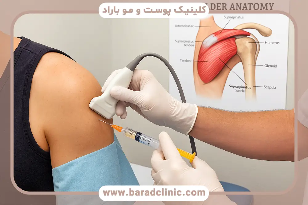prp شانه چیست؟ بررسی کلی