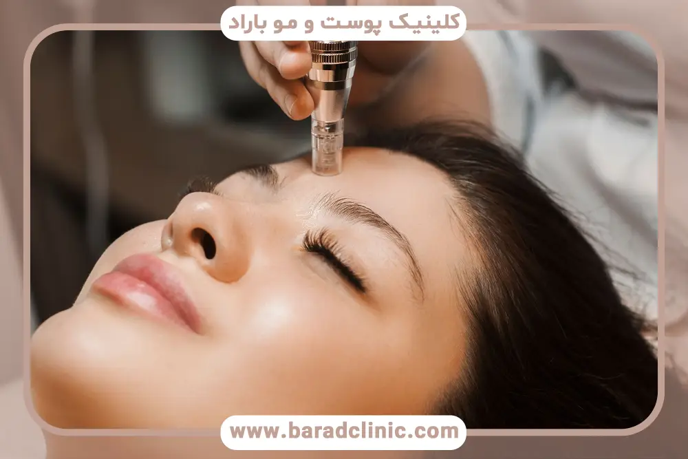 مزوتراپی بهتره یا میکرونیدلینگ؟ آشنایی با مزوتراپی