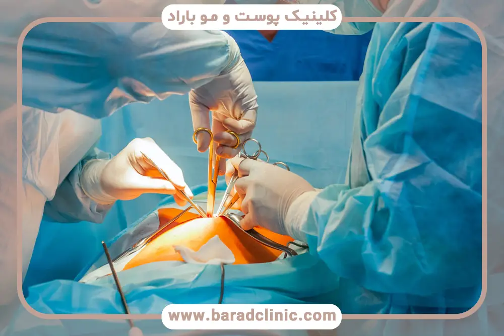 آشنایی با جراحی زیبایی پلک