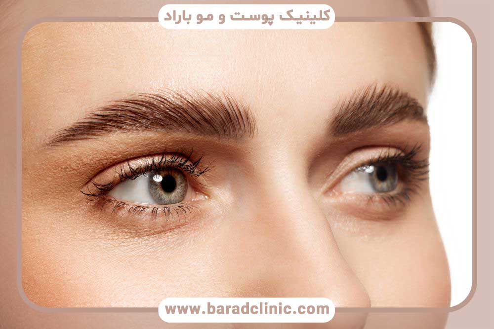 Stitch pain behind the head after eyebrow transplantation