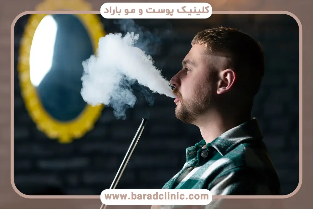 عوارض مصرف قلیان بعد از کاشت مو