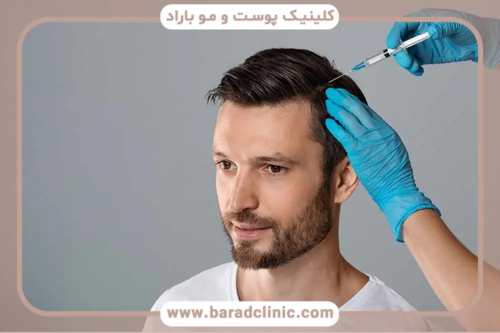 زمان مصرف بهترین داروهای تقویتی بعد از کاشت مو 