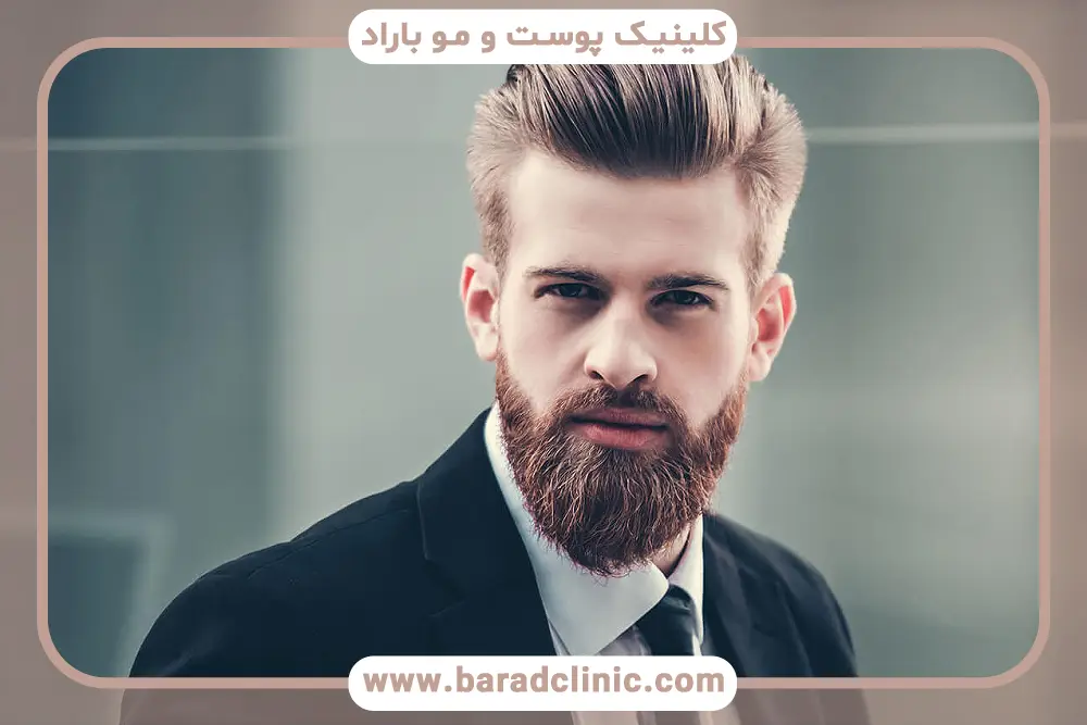 مزایا و تاثیر مزوتراپی ریش 