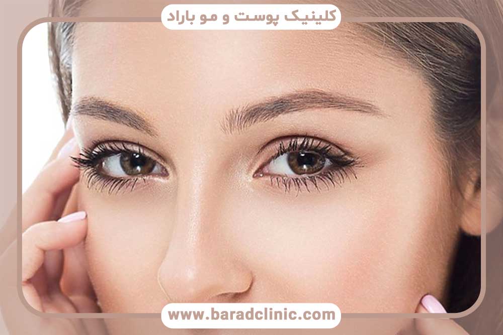 دوره نقاهت کاشت ابرو