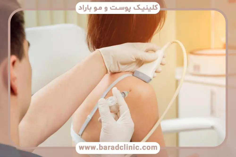کاندیدای مناسب prp شانه