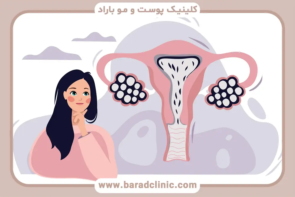 مراحل prp تخمدان چیست