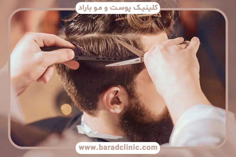 جدول زمانی اصلاح مو بعد از کاشت