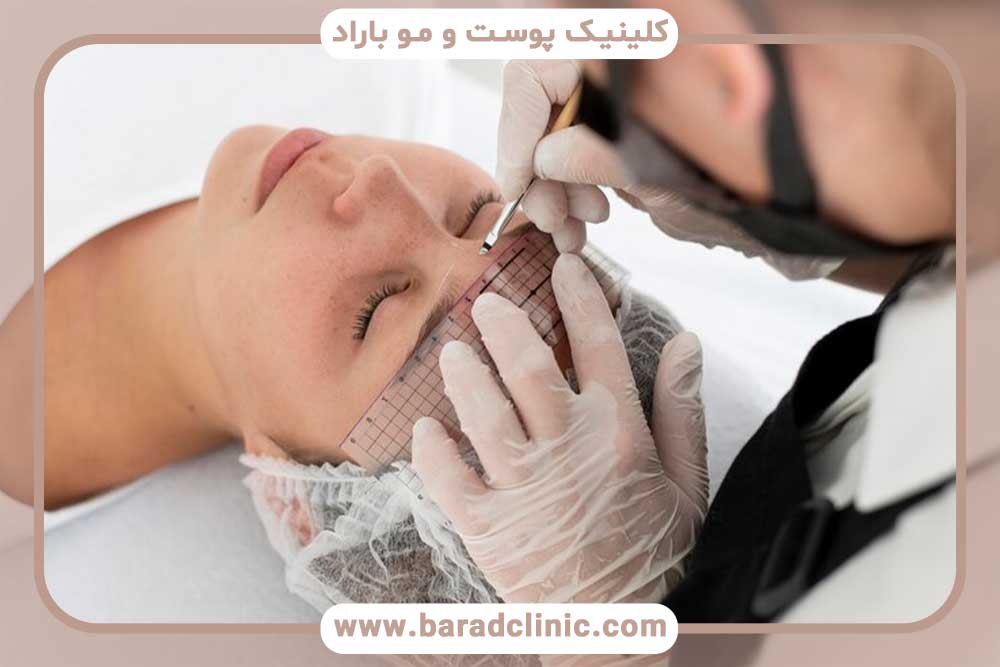 Stitch pain behind the head after eyebrow transplantation