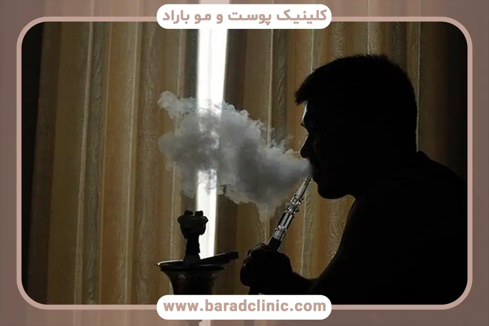 مدت زمان دوری از قلیان بعد از کاشت مو