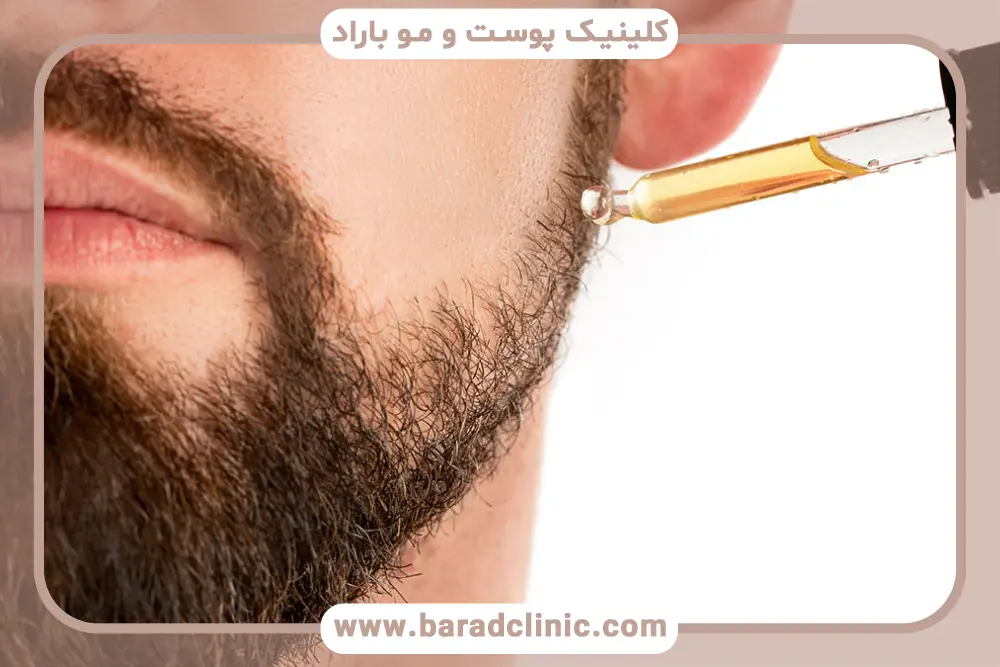 سبک زندگی یک علت کم پشتی ریش 