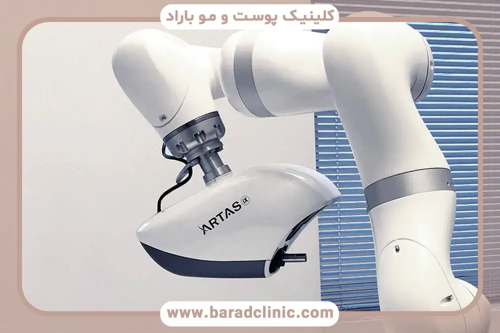 محدودیت‌های دستگاه کاشت مو اتوماتیک