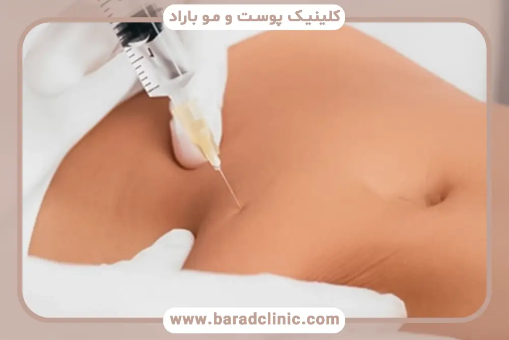 عوارض احتمالی لاغری مزوتراپی 