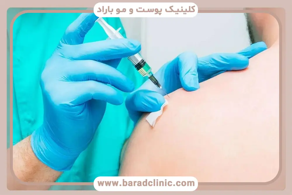 عوارض احتمالی prp شانه چیست