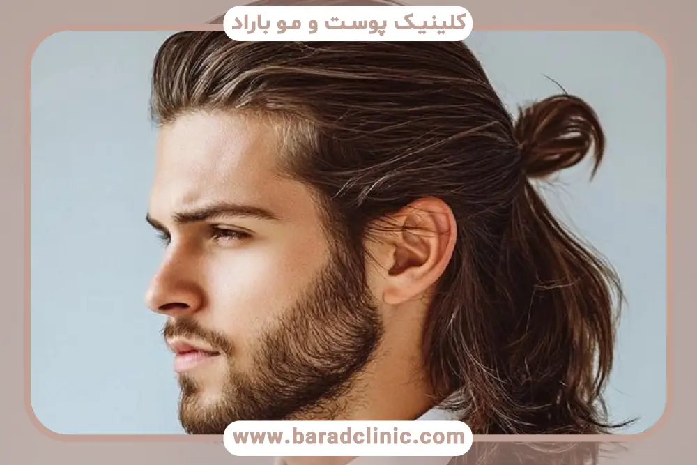 مراقبت‌های قبل و بعد کاشت مو بدون درد و خونریزی 