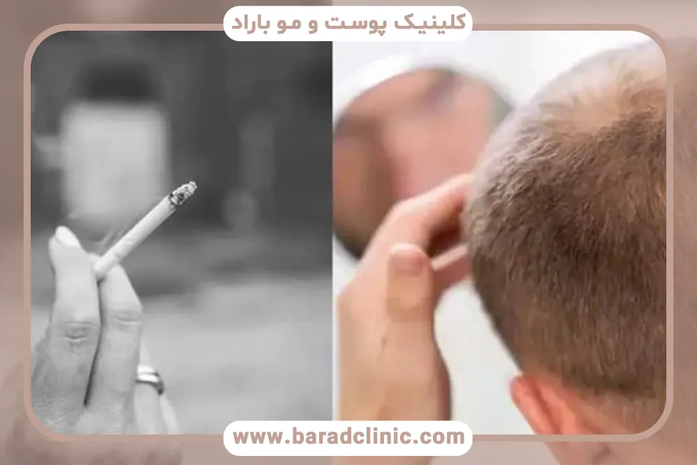 اختلال‌های تغذیه‌ای ناشی از مصرف سیگار