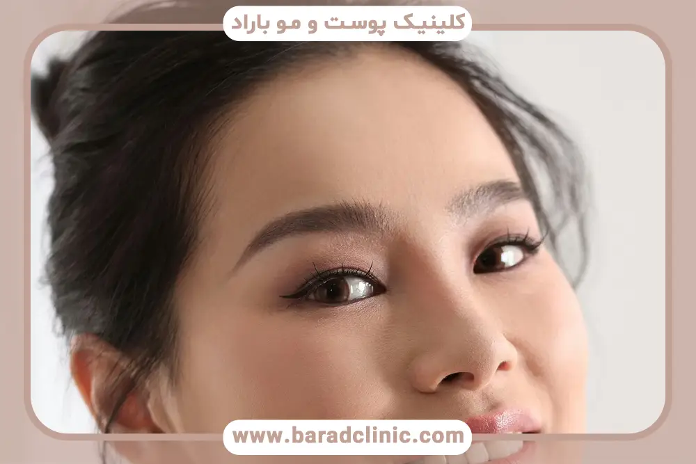 مراقبت‌های قبل از عمل بلفاروپلاستی چشم شرقی 
