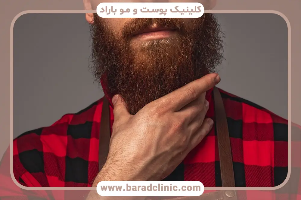 مراحل بهترین مزوتراپی ریش 