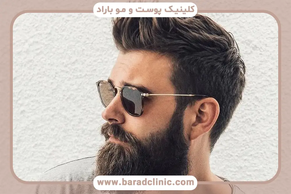 مراقبت‌های بعد از کاشت ریش تهران 