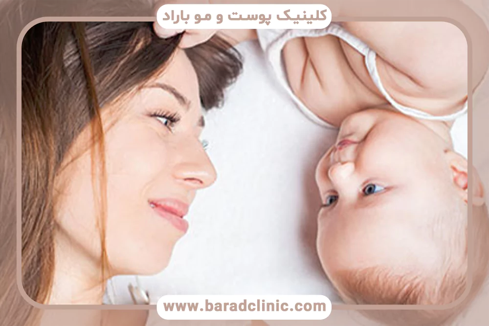 ریزش مو در شیردهی