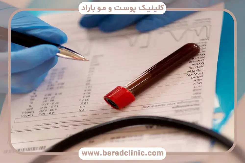 آزمایش های لازم قبل از کاشت ریش