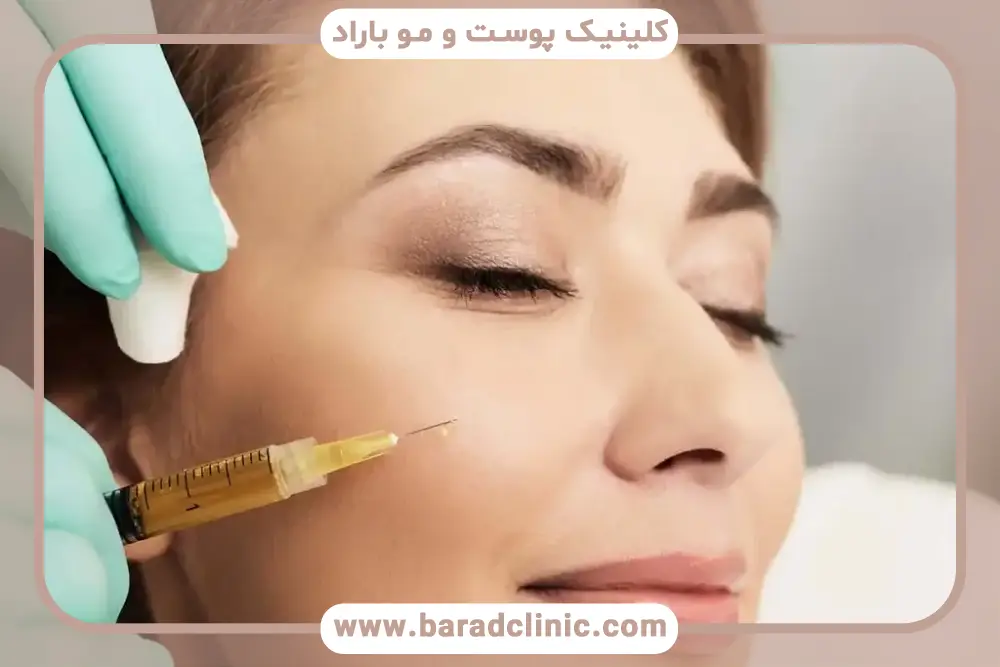 پی‌آر‌پی و نانوفت