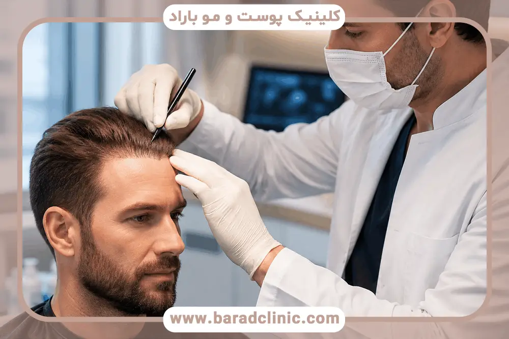 کاشت مو ترمیمی با نیدل