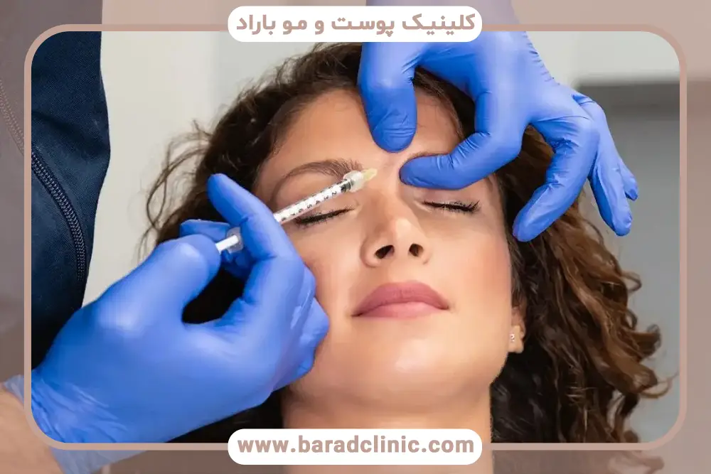 عکس قبل و بعد بوتاکس پیشانی