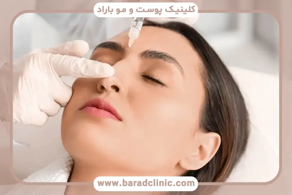 عکس قبل و بعد بوتاکس بینی