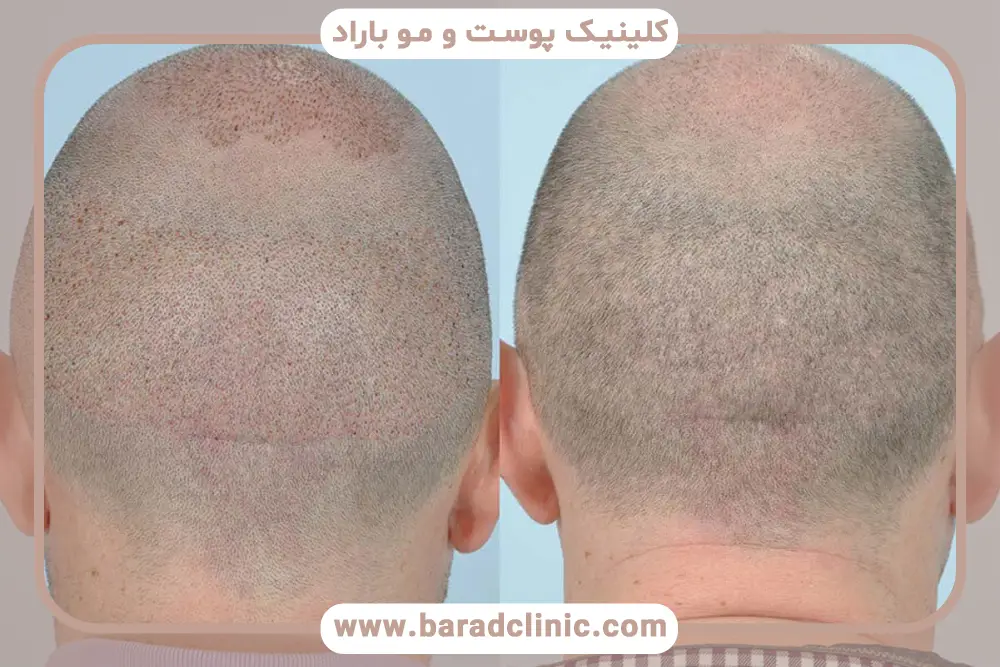 بانک مو یا ناحیه دهنده چیست