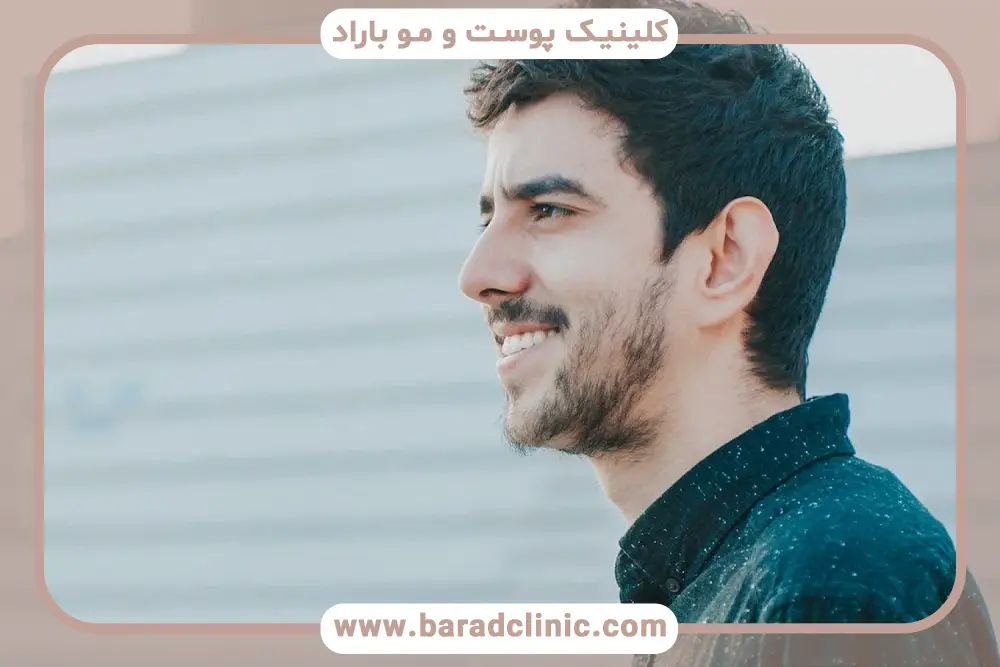 مشکل تستوسترون پایین و ریش