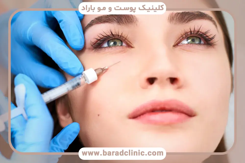 مراقبت بعد از مزوتراپی زیر چشم