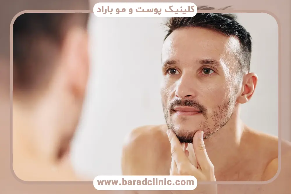 رشد سریع ریش در نوجوانان