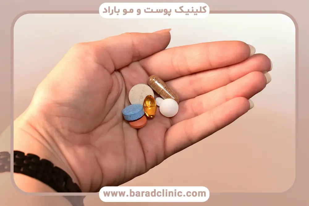 داروهای تقویتی بعد از کاشت مو