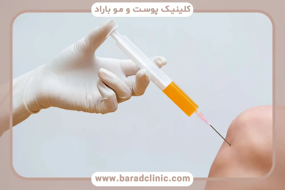 انواع کیت پی آر پی (PRP) 