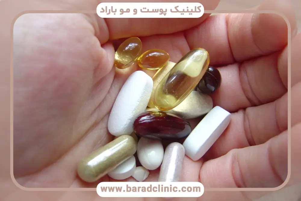 اهمیت مصرف بهترین قرص برای موهای کاشته شده