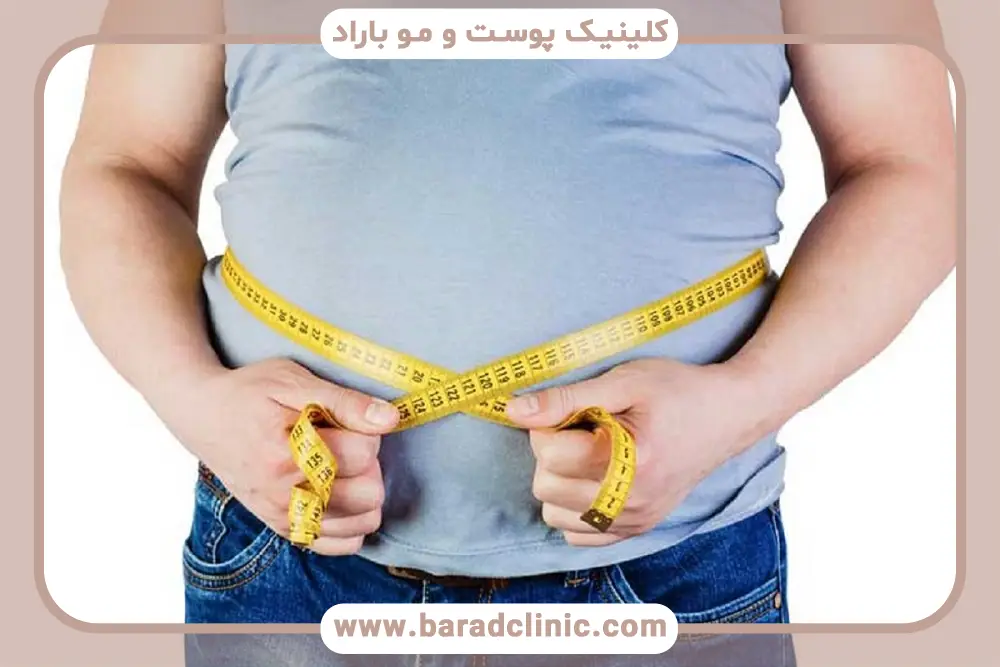 ایمپلنت لاغری چیست؟ بررسی کلی