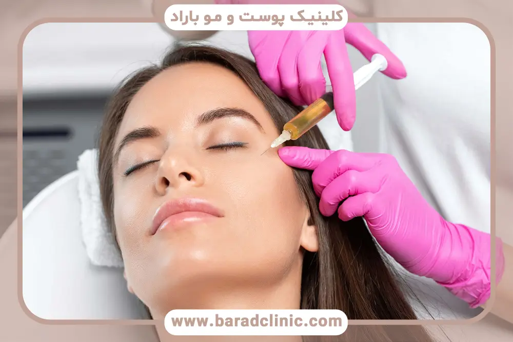 بررسی پی‌آر‌پی و نانوفت 