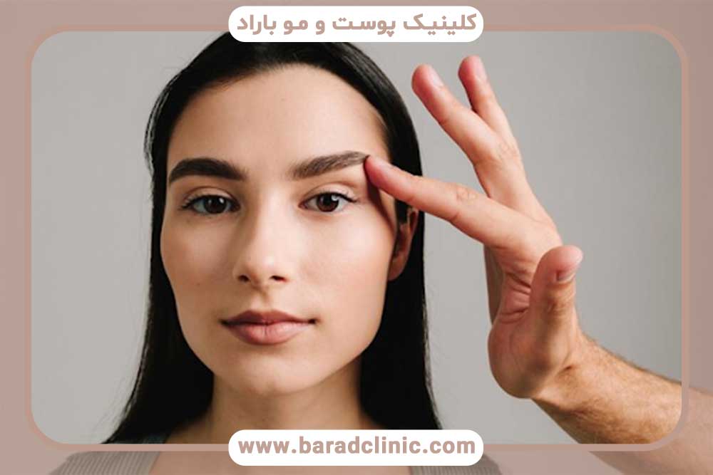 کاشت ابرو