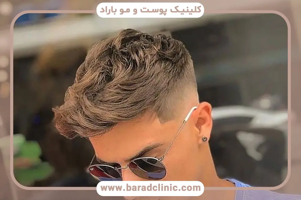 اهمیت بررسی نظرات مردم در مورد کاشت مو به روش sut 
