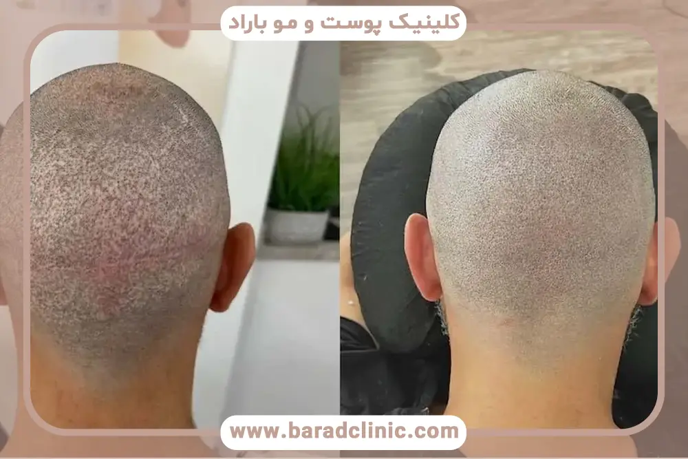 بانک مو یا ناحیه دهنده چیست؟ بررسی کلی