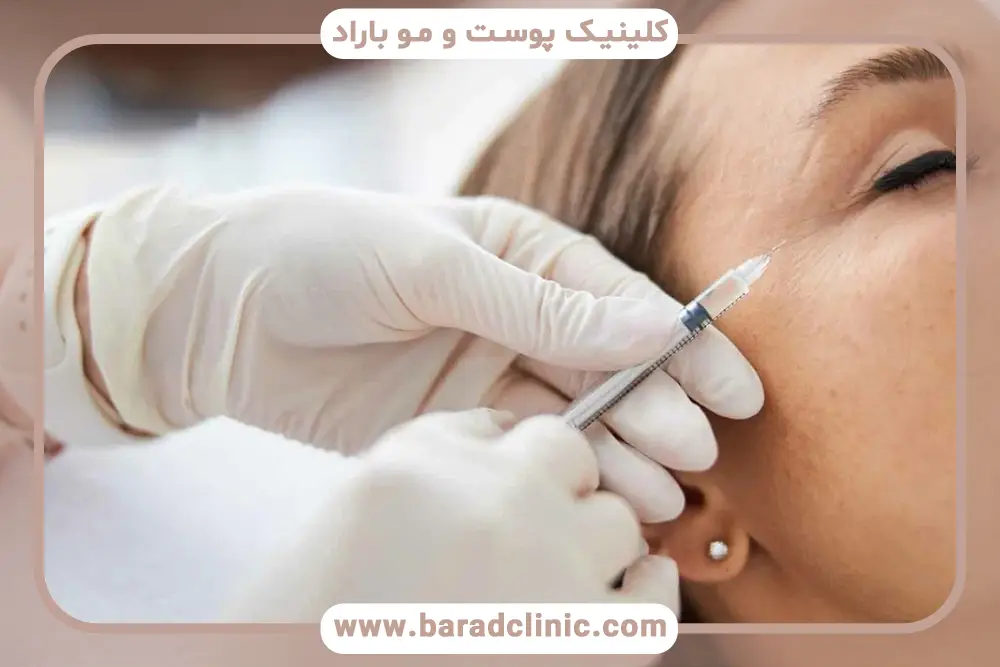افزایش رطوبت مهم‌ترین فایده ی مزوتراپی صورت 