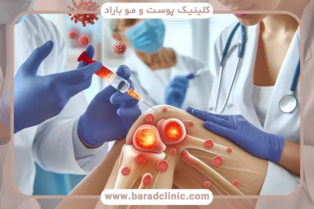 پی‌آر‌پی برای آسیب‌های اسکلتی عضلانی چیست؟