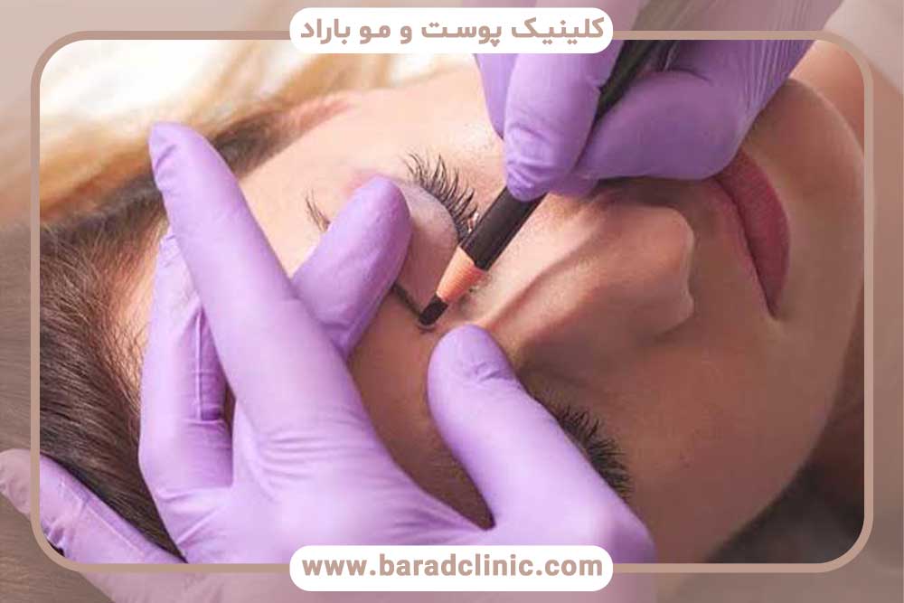 روش‌های میکرو کاشت ابرو