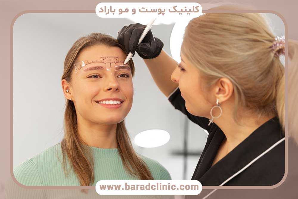 میکرو کاشت ابرو