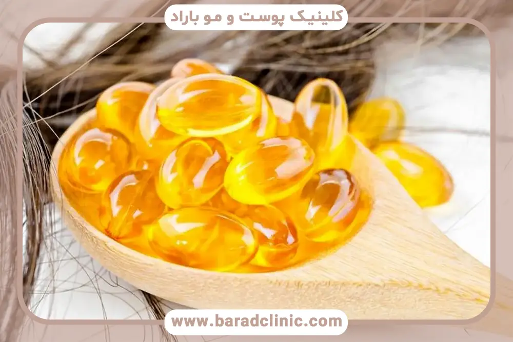 بهترین قرص مکمل بعد از کاشت مو ایرانی