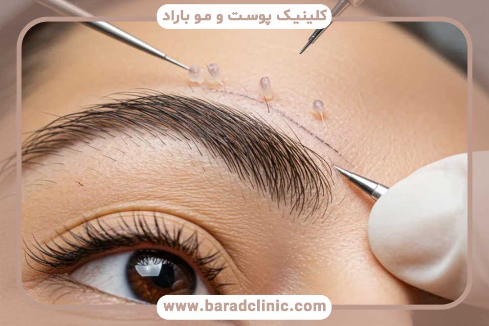 نانوگرافت ابرو