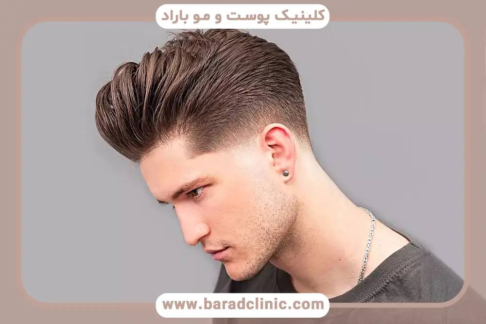 تجهیزات کاشت مو به روش sut در تهران 