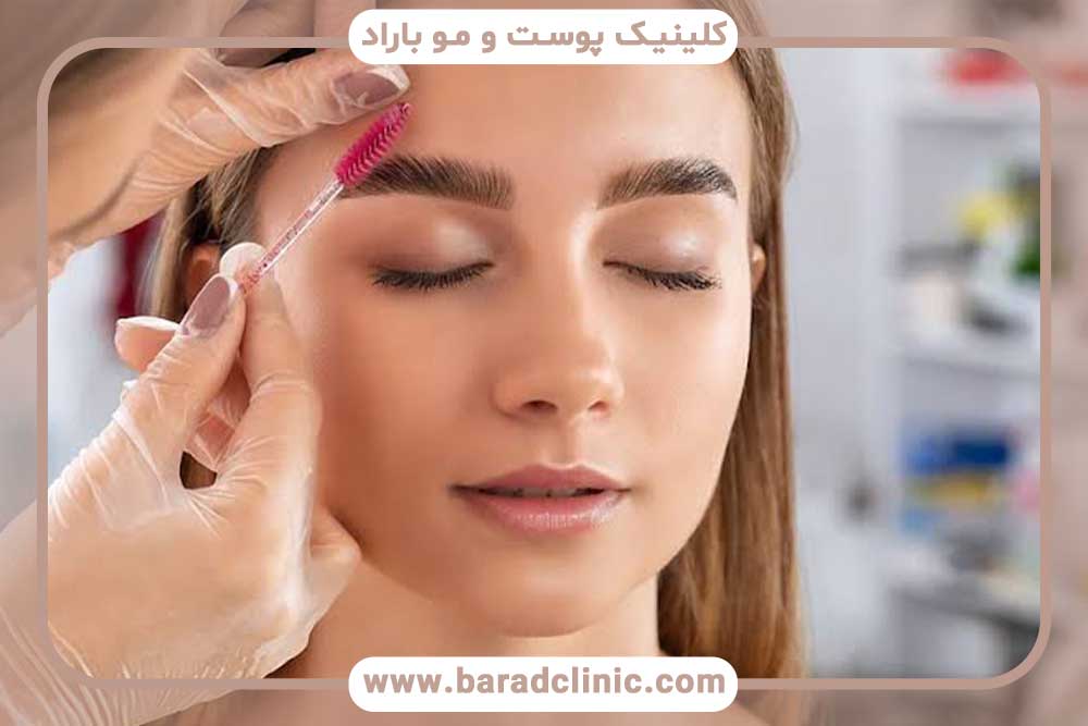 مزایای میکرو کاشت ابرو