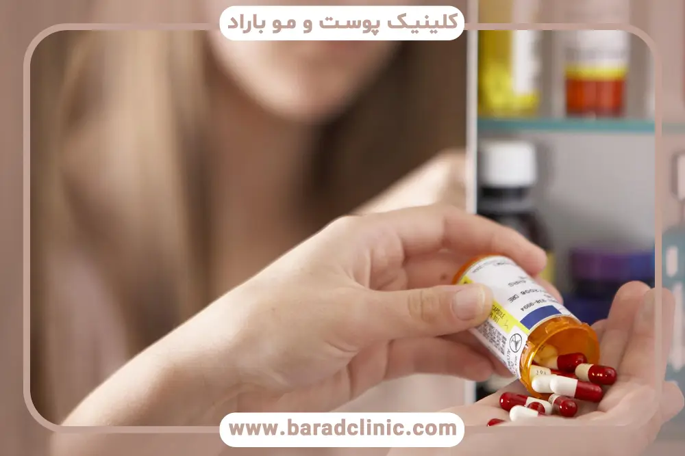 ویژگیهای بهترین مسکن بعد از کاشت مو