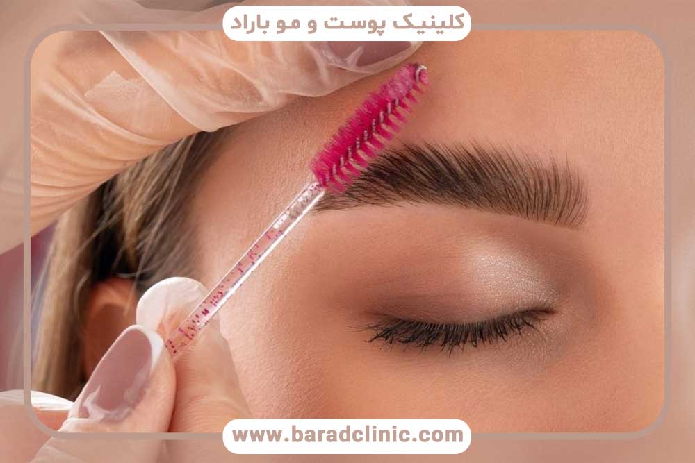 میکرو کاشت ابرو